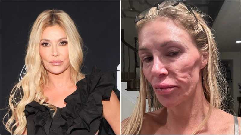 Brandi Glanville Photos